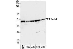 anti-LUC7-Like 2 (LUC7L2) (AA 340-390) antibody