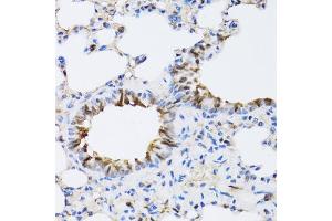 Immunohistochemistry of paraffin-embedded rat lung using NAA10 antibody. (NAA10 anticorps)