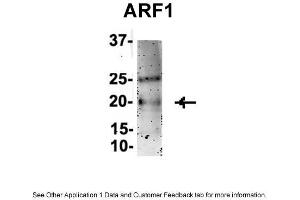Sample Type : Mouse Brain lysate (ARF1 anticorps  (Middle Region))