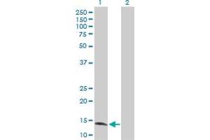 Western Blot analysis of ZNF44 expression in transfected 293T cell line by ZNF44 MaxPab polyclonal antibody. (Zinc Finger Protein 44 anticorps  (AA 1-154))