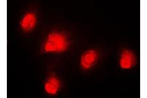 Immunofluorescent analysis of c-RAF staining in HeLa cells. (RAF1 anticorps  (Center))