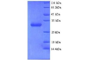 SDS-PAGE (SDS) image for Chromobox Homolog 7 (CBX7) (AA 1-251), (full length) protein (His tag) (ABIN5713322)