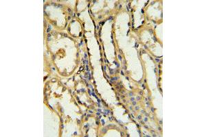 TRAP Antibody IHC analysis in formalin fixed and paraffin embedded human kidney tissue followed by peroxidase conjugation of the secondary antibody and DAB staining. (CD40 Ligand anticorps  (N-Term))