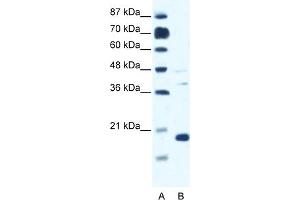 WB Suggested Anti-CACNG1 Antibody Titration:  0. (CACNG1 anticorps  (N-Term))
