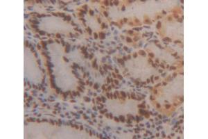 Used in DAB staining on fromalin fixed paraffin- embedded stomach tissue