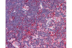 Anti-TNFRSF10A / DR4 antibody IHC of human thymus. (TNFRSF10A anticorps)