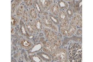 ABIN6266779 at 1/100 staining human kidney tissue sections by IHC-P.