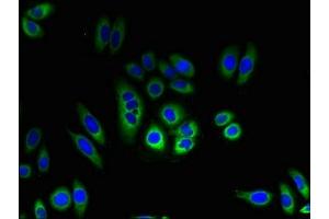 Immunofluorescent analysis of HepG2 cells using ABIN7173111 at dilution of 1:100 and Alexa Fluor 488-congugated AffiniPure Goat Anti-Rabbit IgG(H+L)