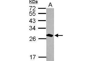 WB Image Sample (20 ug of whole cell lysate) A: mouse brain 12% SDS PAGE antibody diluted at 1:30000