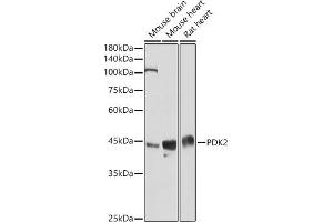 Western blot analysis of extracts of various cell lines, using PDK2 antibody (ABIN1681304, ABIN3018413, ABIN3018414 and ABIN6220461) at 1:3000 dilution.