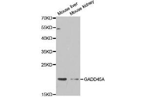 Western blot analysis of extracts of various cell lines, using GADD45A antibody. (GADD45A anticorps  (AA 1-165))