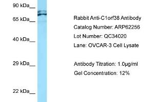 Western Blotting (WB) image for anti-Chromosome 1 Open Reading Frame 38 (C1orf38) (C-Term) antibody (ABIN2789083) (C1orf38 anticorps  (C-Term))