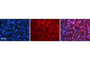 Rabbit Anti-MBD2 Antibody    Formalin Fixed Paraffin Embedded Tissue: Human Adult liver  Observed Staining: Nuclear Primary Antibody Concentration: 1:100 Secondary Antibody: Donkey anti-Rabbit-Cy2/3 Secondary Antibody Concentration: 1:200 Magnification: 20X Exposure Time: 0. (MBD2 anticorps  (N-Term))