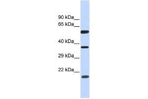 WB Suggested Anti-NT5DC1 Antibody Titration: 0. (NT5DC1 anticorps  (N-Term))