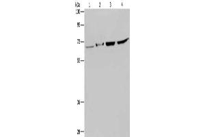 Gel: 8 % SDS-PAGE, Lysate: 40 μg, Lane 1-4: Human testis tissue, mouse liver tissue, Hela cells, 293T cells, Primary antibody: ABIN7129681(HACL1 Antibody) at dilution 1/200, Secondary antibody: Goat anti rabbit IgG at 1/8000 dilution, Exposure time: 5 minutes (HACL1 anticorps)