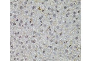 Immunohistochemistry of paraffin-embedded Mouse liver using SKP2 Polyclonal Antibody at dilution of 1:100 (40x lens). (SKP2 anticorps)