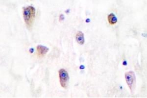 Image no. 2 for anti-Glutamate Receptor, Ionotropic, Kainate 1 (GRIK1) antibody (ABIN265438) (GRIK1 anticorps)