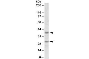 Western blot testing of human cerebellum lysate with Podoplanin antibody at 1ug/ml. (Podoplanin anticorps)