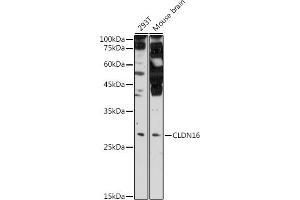 Western blot analysis of extracts of various cell lines, using CLDN16 antibody (ABIN6133646, ABIN6138679, ABIN6138680 and ABIN6225195) at 1:500 dilution. (Claudin 16 anticorps  (AA 50-150))