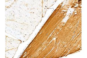 ABIN6263820 and ABIN6276785 at 1/100 staining Rat muscle tissue by IHC-P. (OLR1 anticorps  (N-Term))