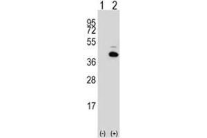 Western blot analysis of PITX1 antibody and 293 cell lysate either nontransfected (Lane 1) or transiently transfected (2) with the PITX1 gene.