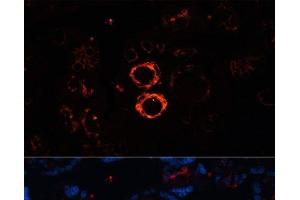Immunofluorescence analysis of Human placenta cells using MYH11 Polyclonal Antibody at dilution of 1:100. (MYH11 anticorps)