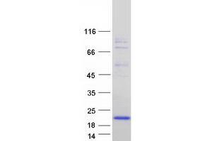 Validation with Western Blot