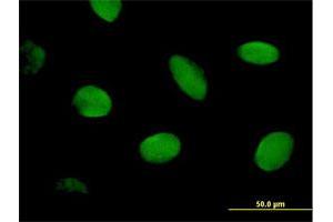 Immunofluorescence of purified MaxPab antibody to CHD2 on HeLa cell. (CHD2 anticorps  (AA 1-501))