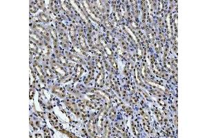 IHC analysis of HOXC4 using anti-HOXC4 antibody (ABIN7603059). (HOXC4 anticorps  (Middle Region))