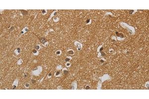 Immunohistochemistry of paraffin-embedded Human brain tissue using KIF4A Polyclonal Antibody at dilution 1:40 (KIF4A anticorps)