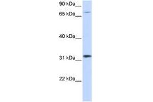 Image no. 1 for anti-Zinc Finger Protein 799 (ZNF799) (AA 261-310) antibody (ABIN6744479) (ZNF799 anticorps  (AA 261-310))