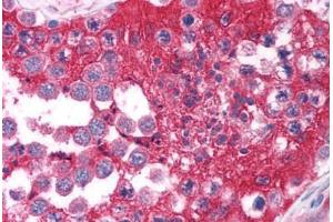Human Testis (formalin-fixed, paraffin-embedded) stained with FOXE3 antibody ABIN214754 at 5 ug/ml followed by biotinylated goat anti-rabbit IgG secondary antibody ABIN481713, alkaline phosphatase-streptavidin and chromogen.