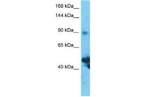 Host:  Rabbit  Target Name:  SLC39A10  Sample Type:  Thymus Tumor lysates  Antibody Dilution:  1. (SLC39A10 anticorps  (N-Term))