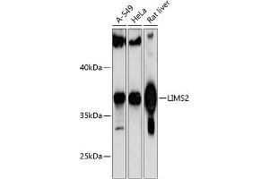 Western blot analysis of extracts of various cell lines, using LIMS2 antibody (ABIN6132166, ABIN6143236, ABIN6143237 and ABIN6217146) at 1:1000 dilution. (LIMS2 anticorps  (AA 1-341))