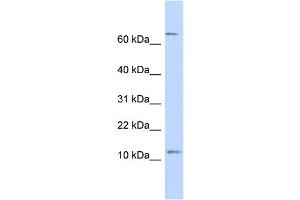 WB Suggested Anti-TRA16 Antibody Titration: 0. (NR2C2AP anticorps  (N-Term))