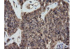 Image no. 1 for anti-Protein Disulfide Isomerase Family A, Member 3 (PDIA3) antibody (ABIN1498107)