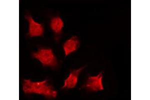 ABIN6267223 staining HeLa by IF/ICC.