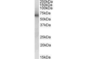 Western blot analysis: ALDH1B1 antibody staining of Human Liver lysate at 0. (ALDH1B1 anticorps  (Internal Region))