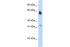 Western Blotting (WB) image for anti-Lysine (K)-Specific Demethylase 4D (KDM4D) antibody (ABIN2461887) (JMJD2D anticorps)