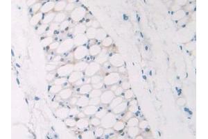 Detection of NPM1 in Mouse Adipose tissue Tissue using Polyclonal Antibody to Nucleophosmin 1 (NPM1)