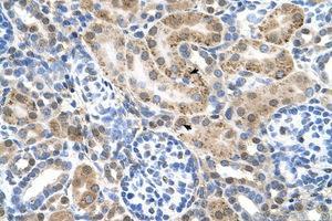 anti-Organic Cation Transporter 3 (OCT3) (AA 46-95) antibody