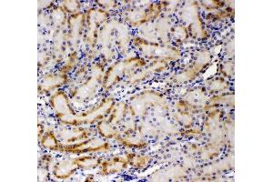 IHC analysis of AMFR using anti-AMFR antibody (ABIN4886455). (AMFR anticorps  (AA 553-643))