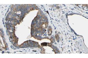 ABIN6274964 at 1/100 staining Human prostate tissue by IHC-P. (CBR1 anticorps  (C-Term))