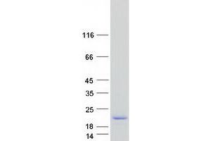 Validation with Western Blot