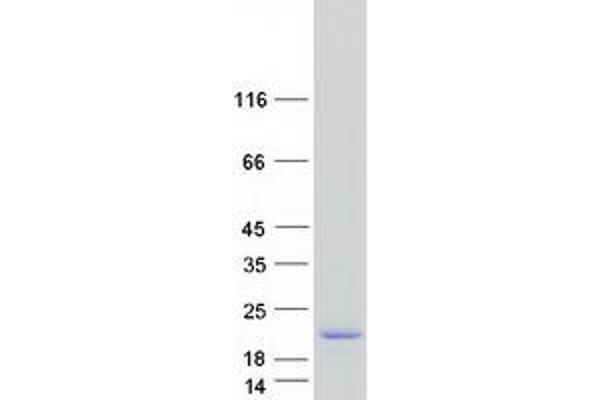 Chromosome X Open Reading Frame 27 (CXORF27) protein (Myc-DYKDDDDK Tag)