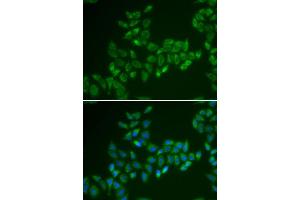 Immunofluorescence analysis of HeLa cell using CRAT antibody. (CRAT anticorps)
