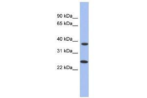 WB Suggested Anti-MTRF1L Antibody Titration: 0. (MTRF1L anticorps  (N-Term))