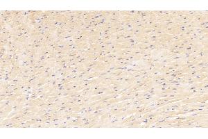Detection of MYOG in Rat Cardiac Muscle Tissue using Polyclonal Antibody to Myogenin (MYOG)