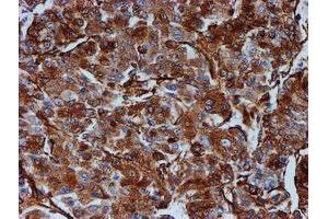Immunohistochemistry (IHC) image for anti-Tubulin beta 4a (TUBB4A) antibody (ABIN1501579)