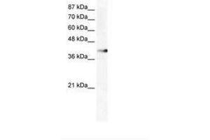 Image no. 1 for anti-Zinc Finger Protein 556 (ZNF556) (AA 322-371) antibody (ABIN202562) (ZNF556 anticorps  (AA 322-371))